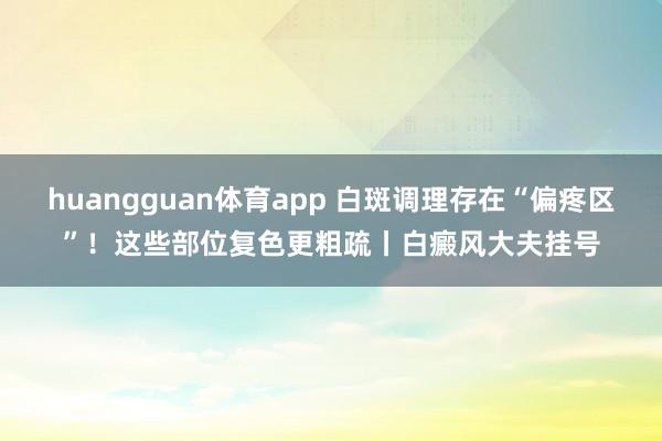 huangguan体育app 白斑调理存在“偏疼区”！这些部位复色更粗疏丨白癜风大夫挂号